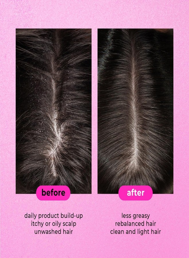 ONLY4HAIR شامبو مقشر 2 في 1 من أونلي فور هير - Image 5
